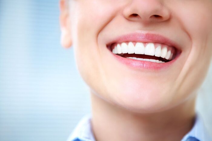Trust an Expert for Teeth Whitening